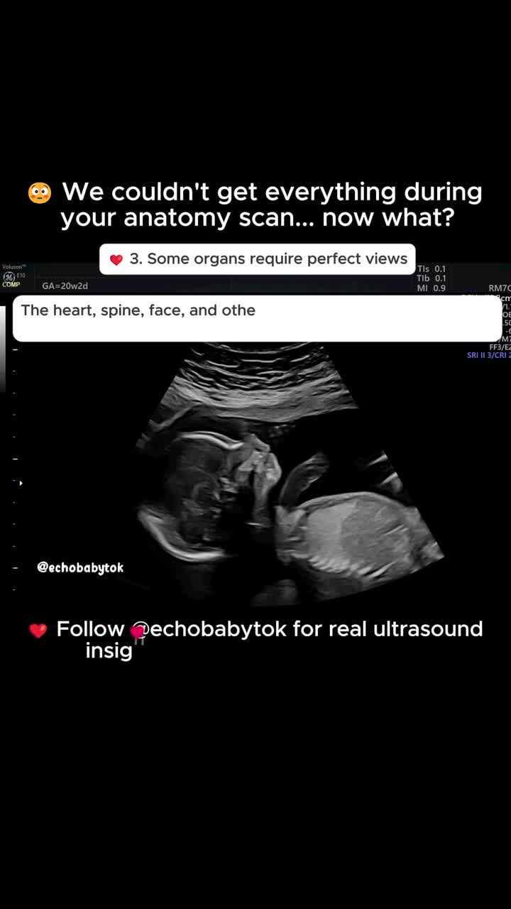 @Echobaby