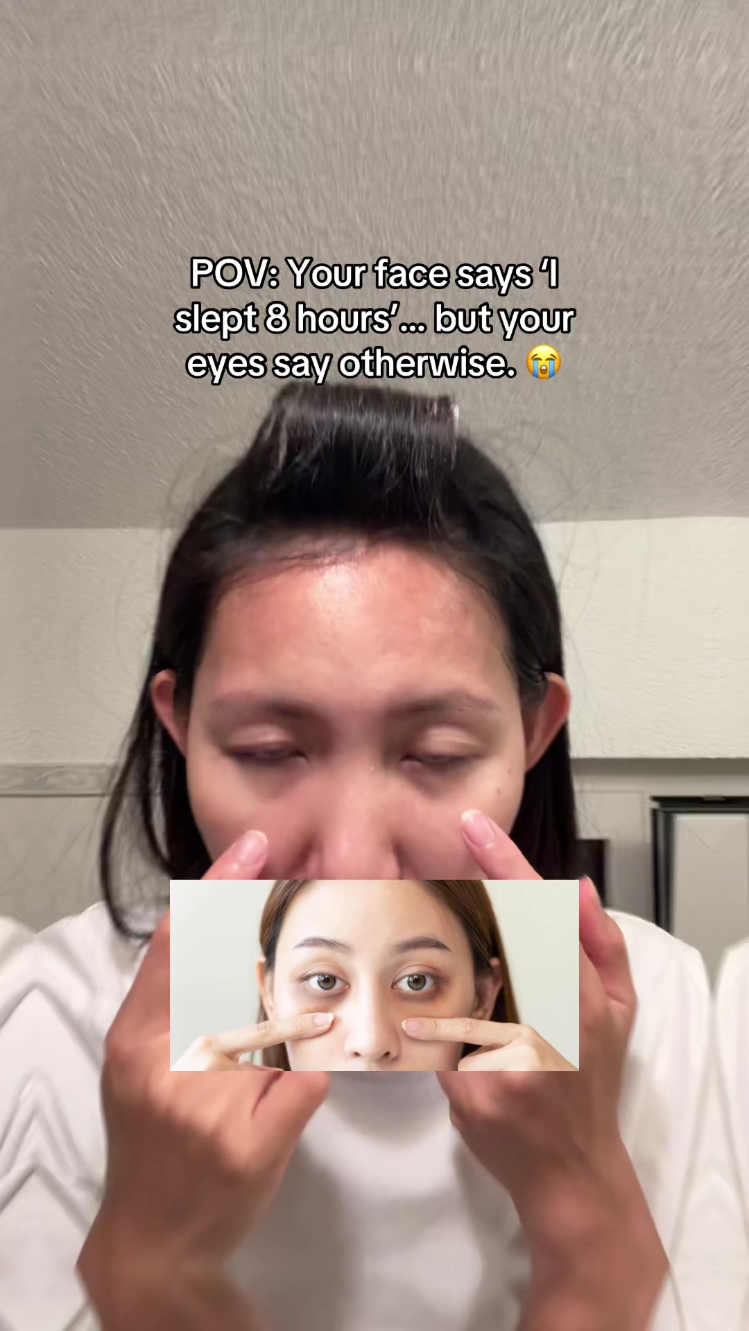 @storyofanacnefighter
