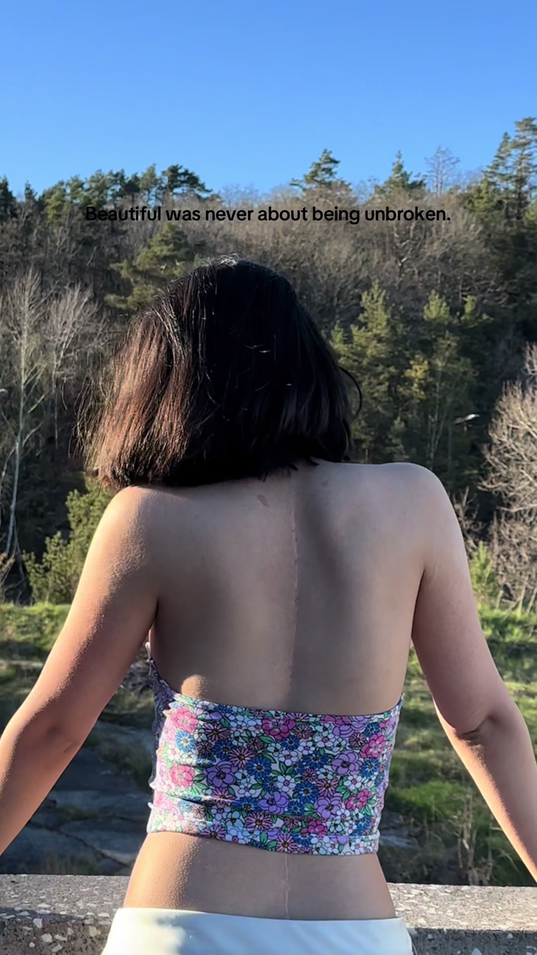 @Yasamin [Scoliosis]
