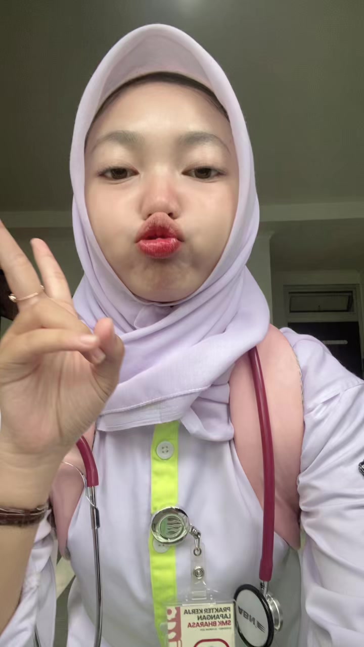 @ervinac