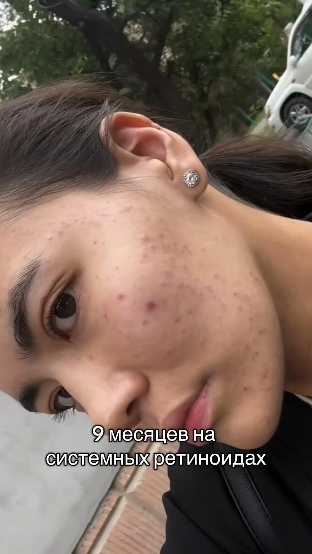 @Aisha
