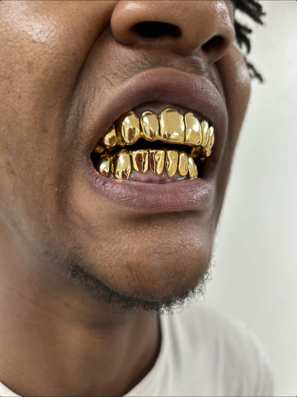 @LouieDaJewelryGuy