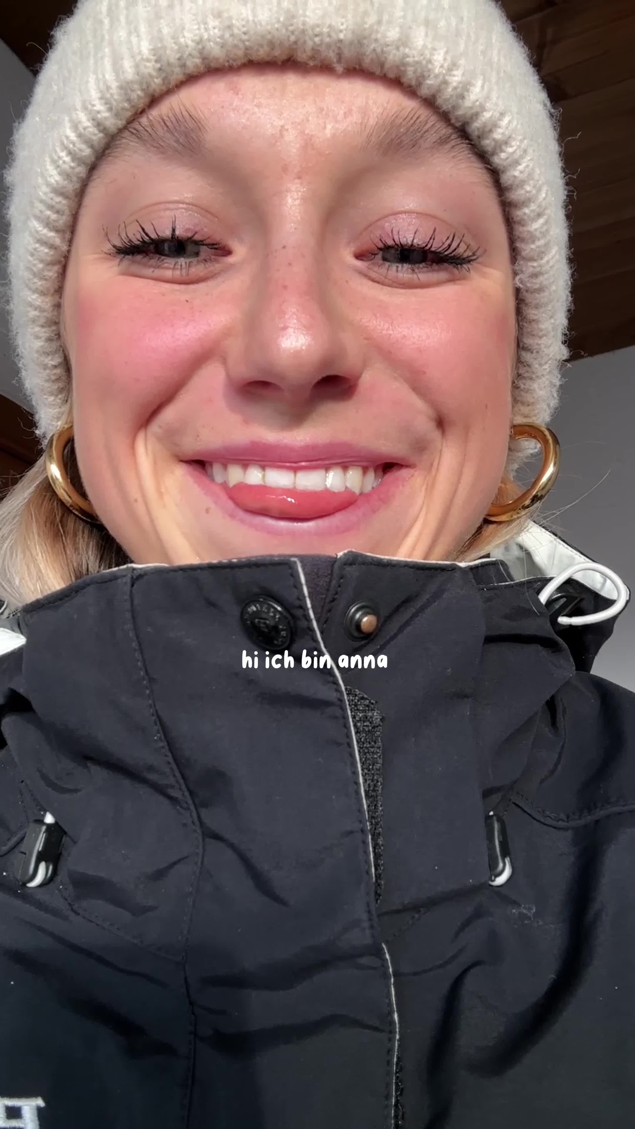@anna