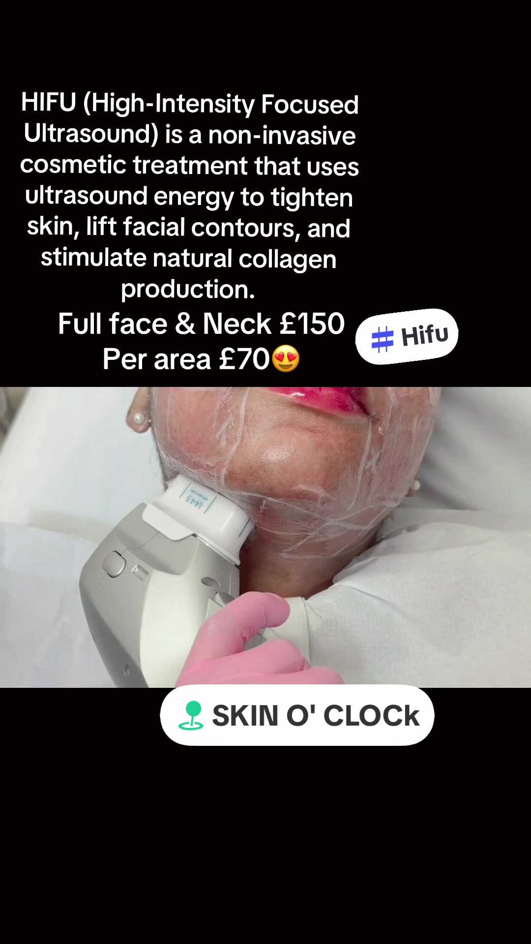 @skinoclockuk
