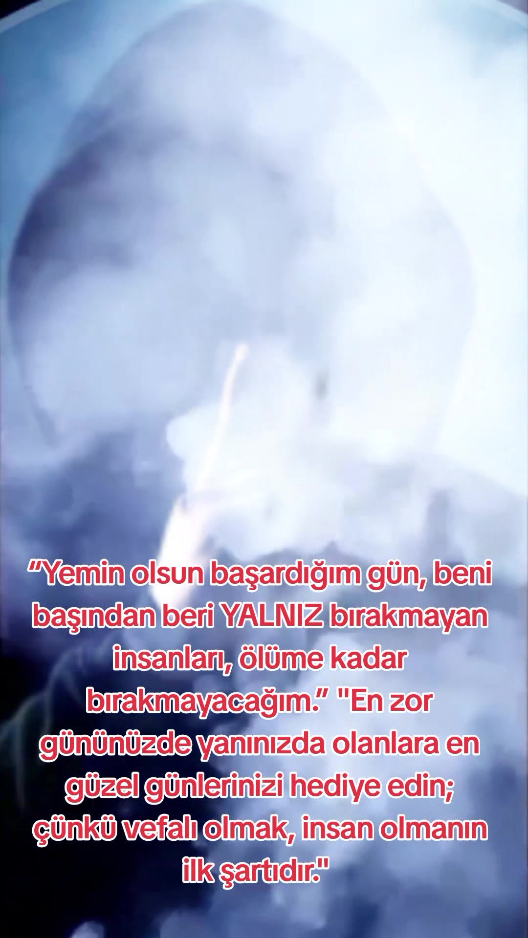 @Ahmedi Yankeski