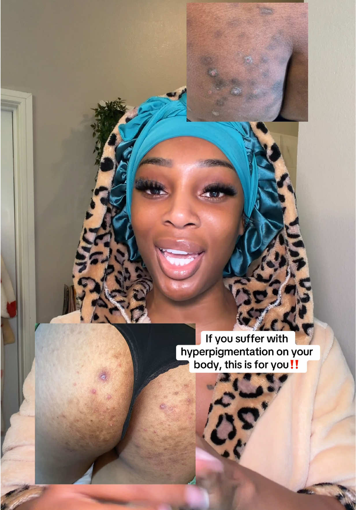 @Poppinss🇳🇬💕