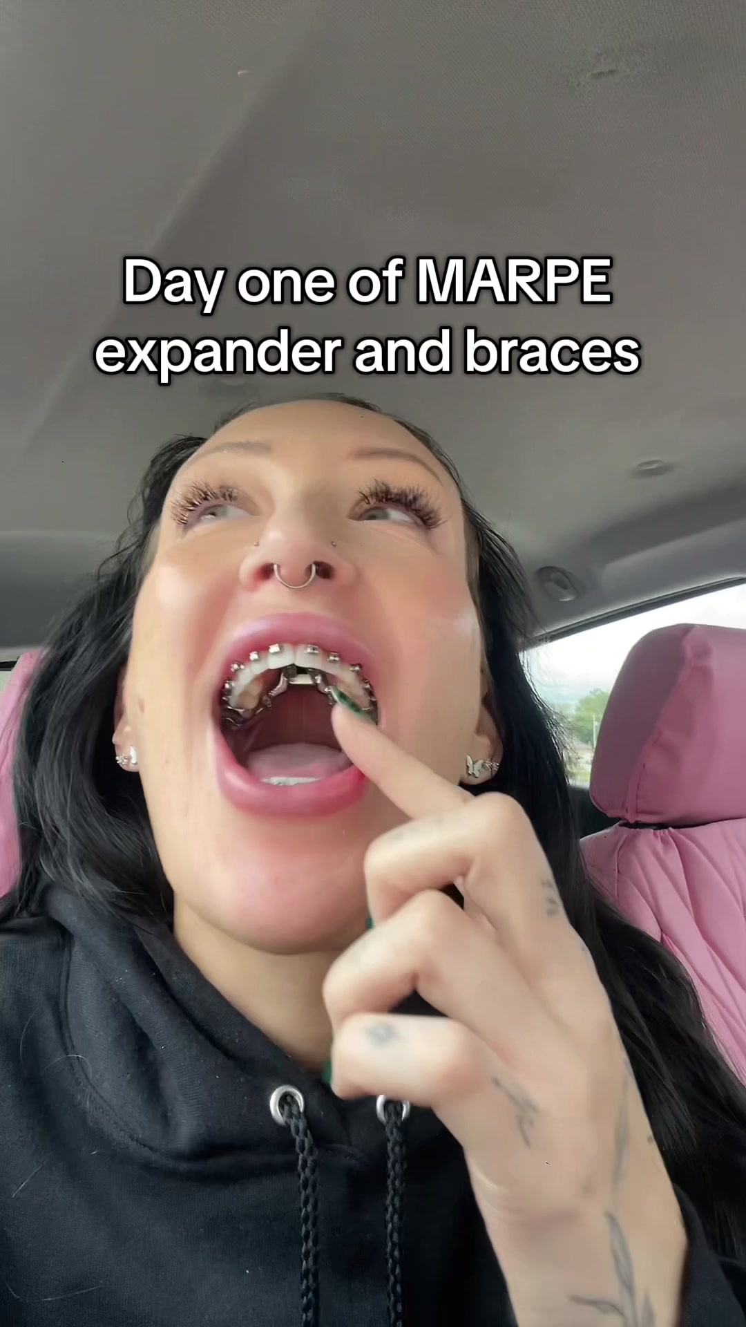 @Hope Rae VonLumen