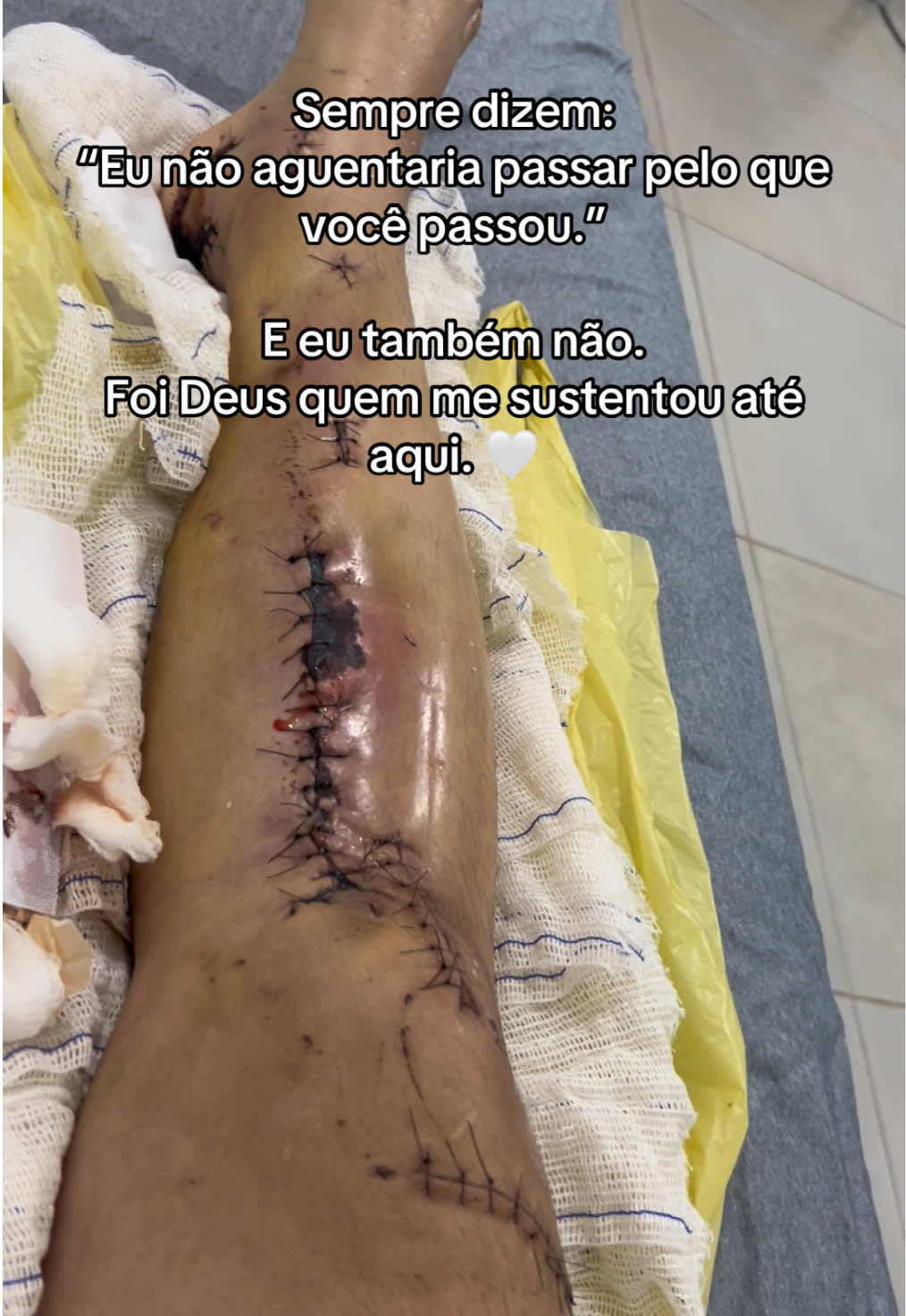 @Ana