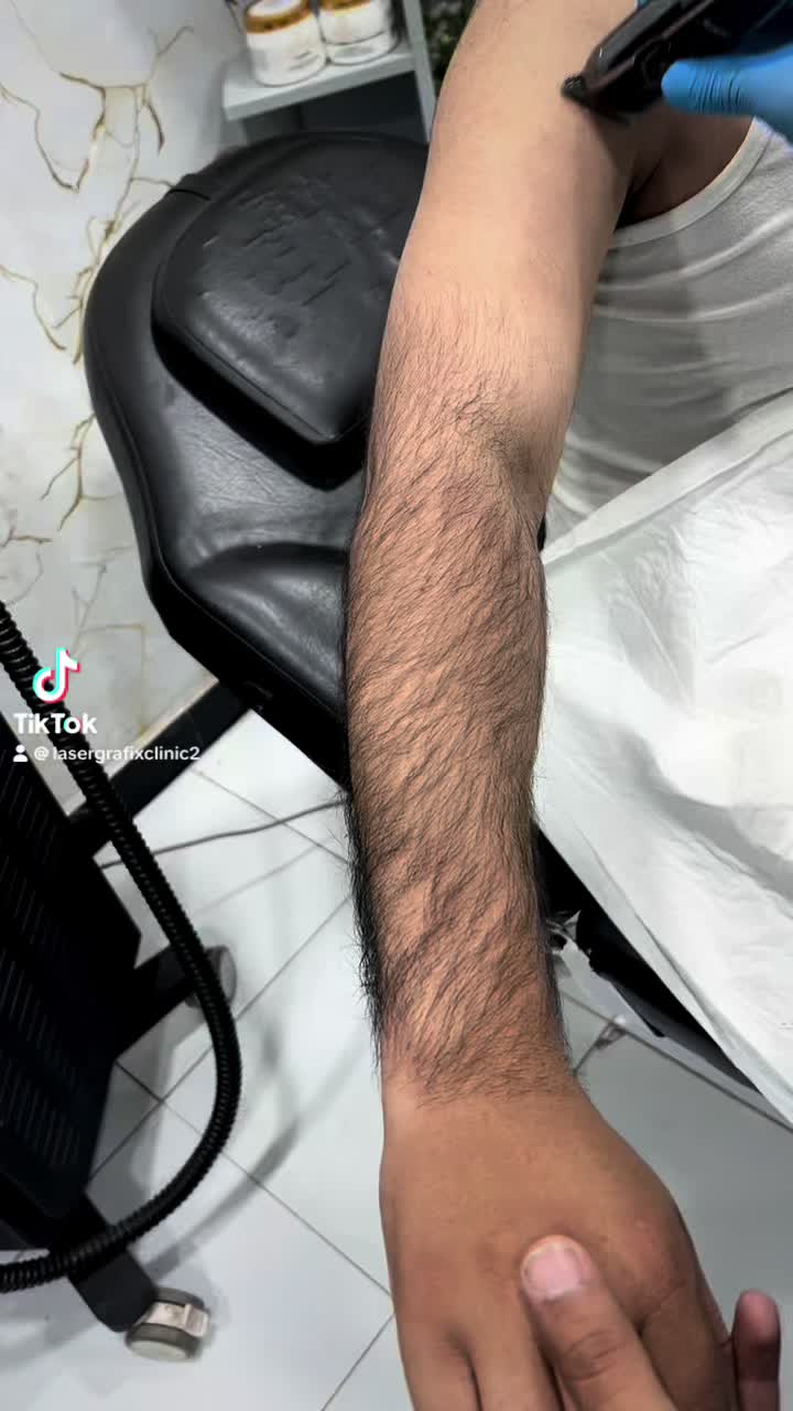 @Laser Grafix clinic