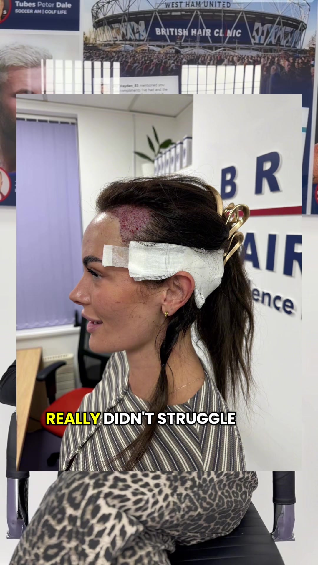 @British Hair Clinic