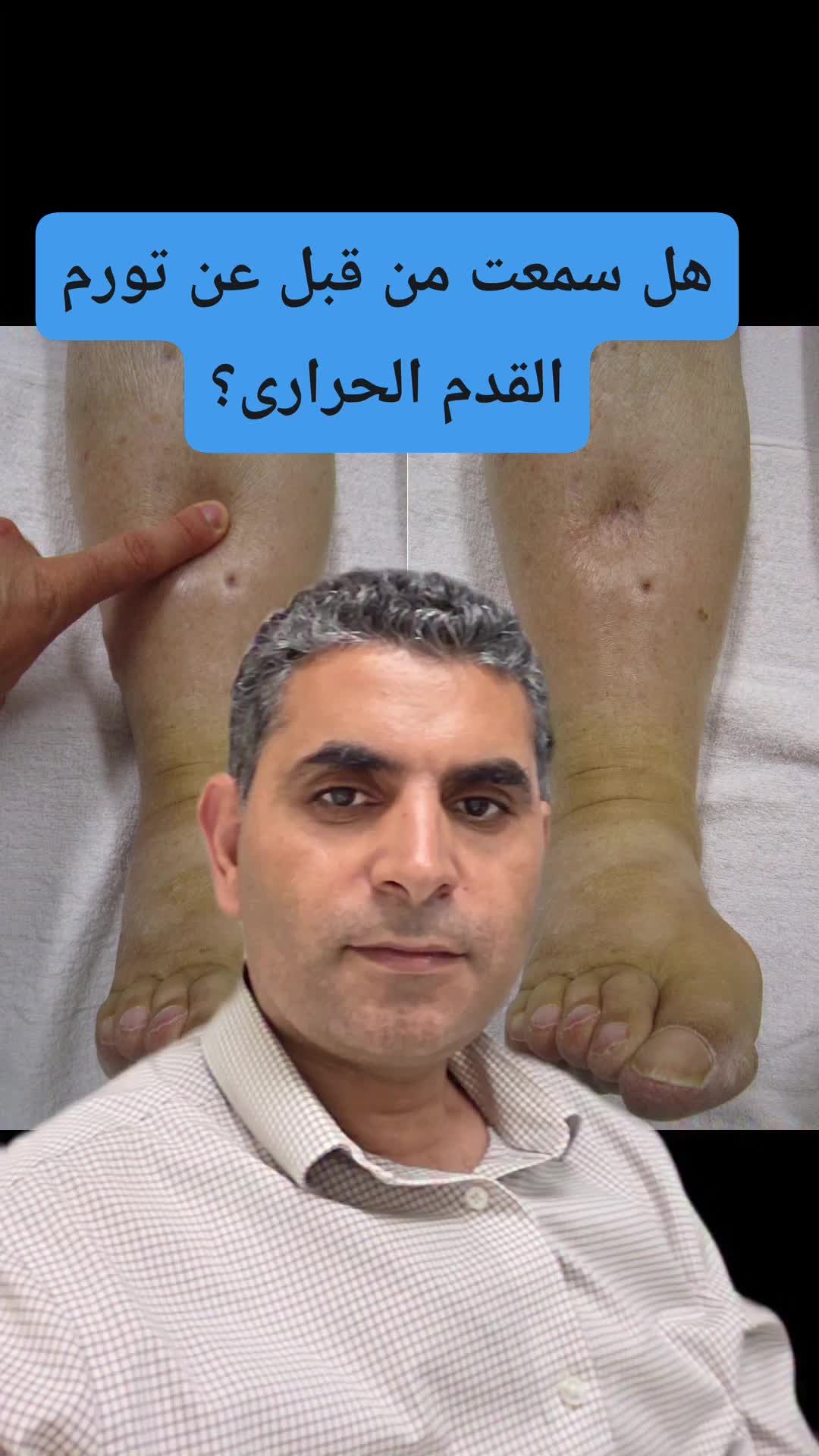 @Dr. Waleed Attia