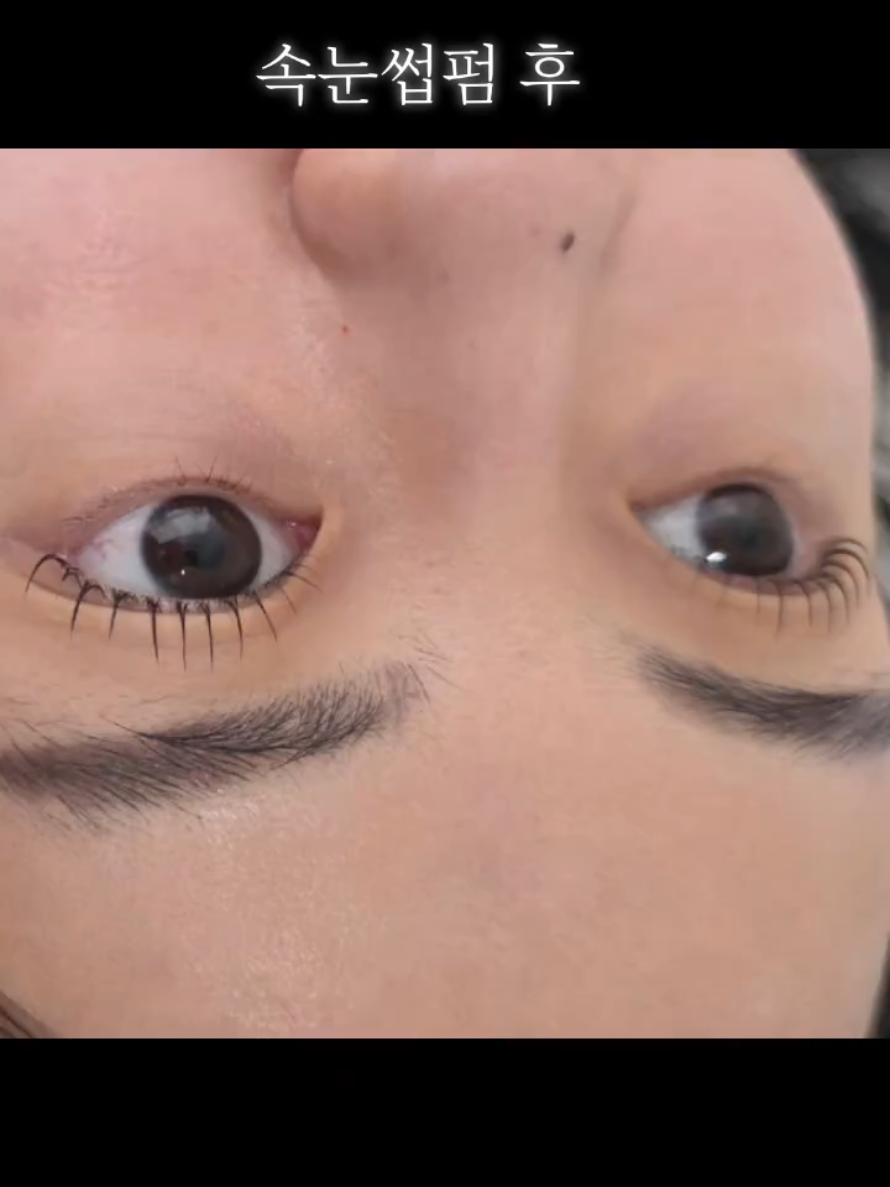 @현지