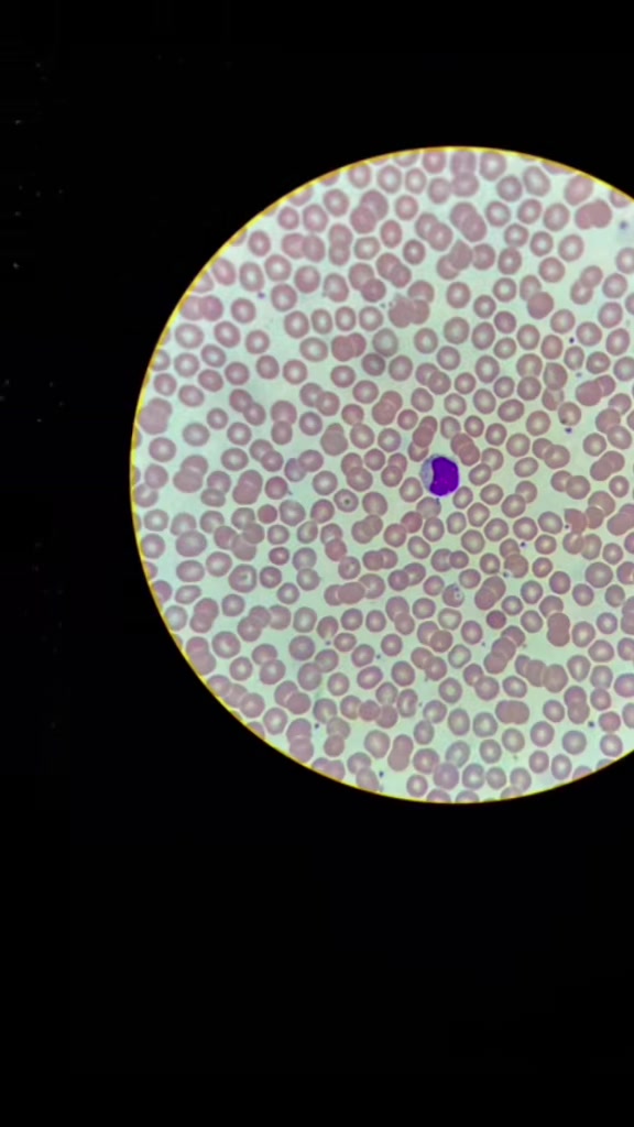 @ALab 🔬💉🩸