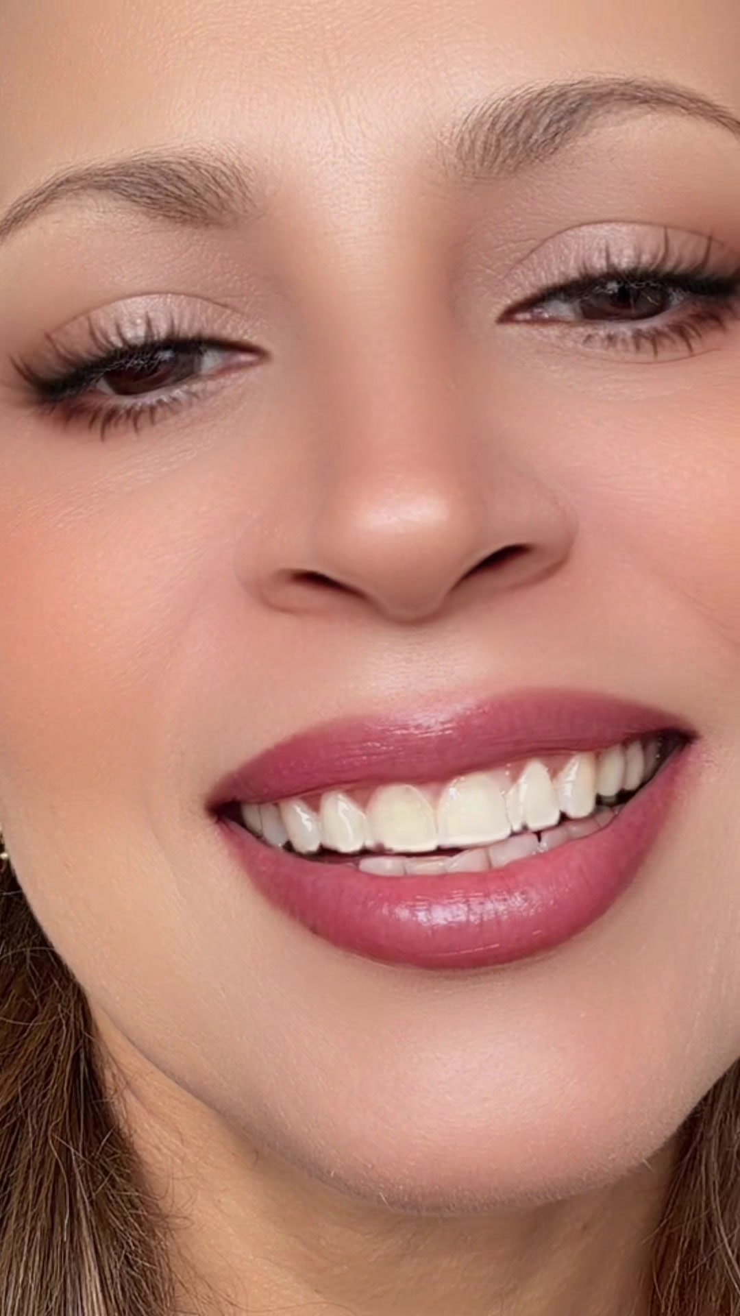 @Suzana Alves