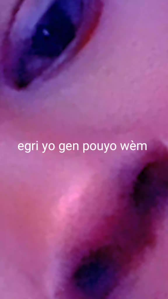 @yolene bellony
