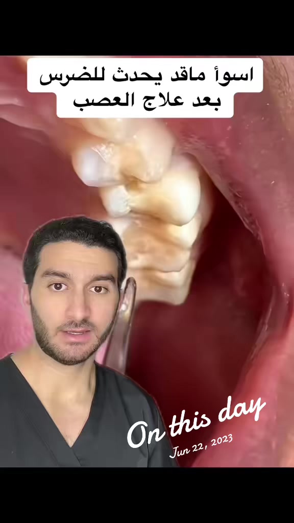 @Dr.Abdulrahman Alakrami