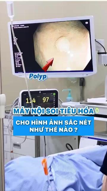 @Nội Soi Ti&ecirc;u H&oacute;a Cần Thơ