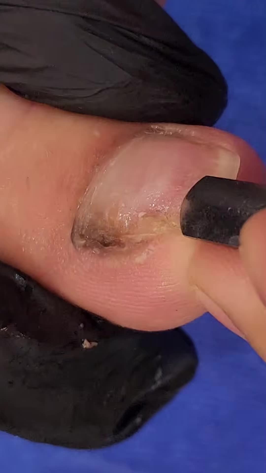@Toenails.clips