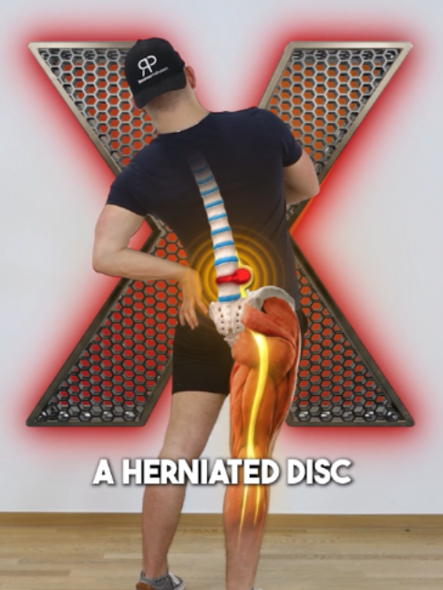 @Recover Pain
