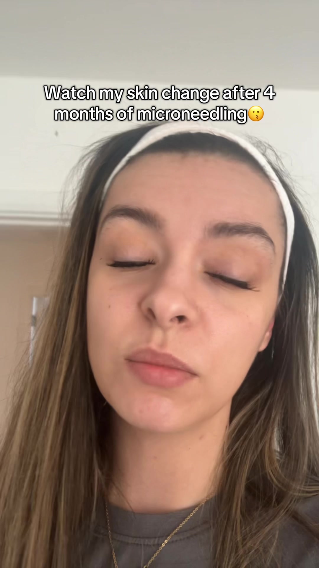 @Toni