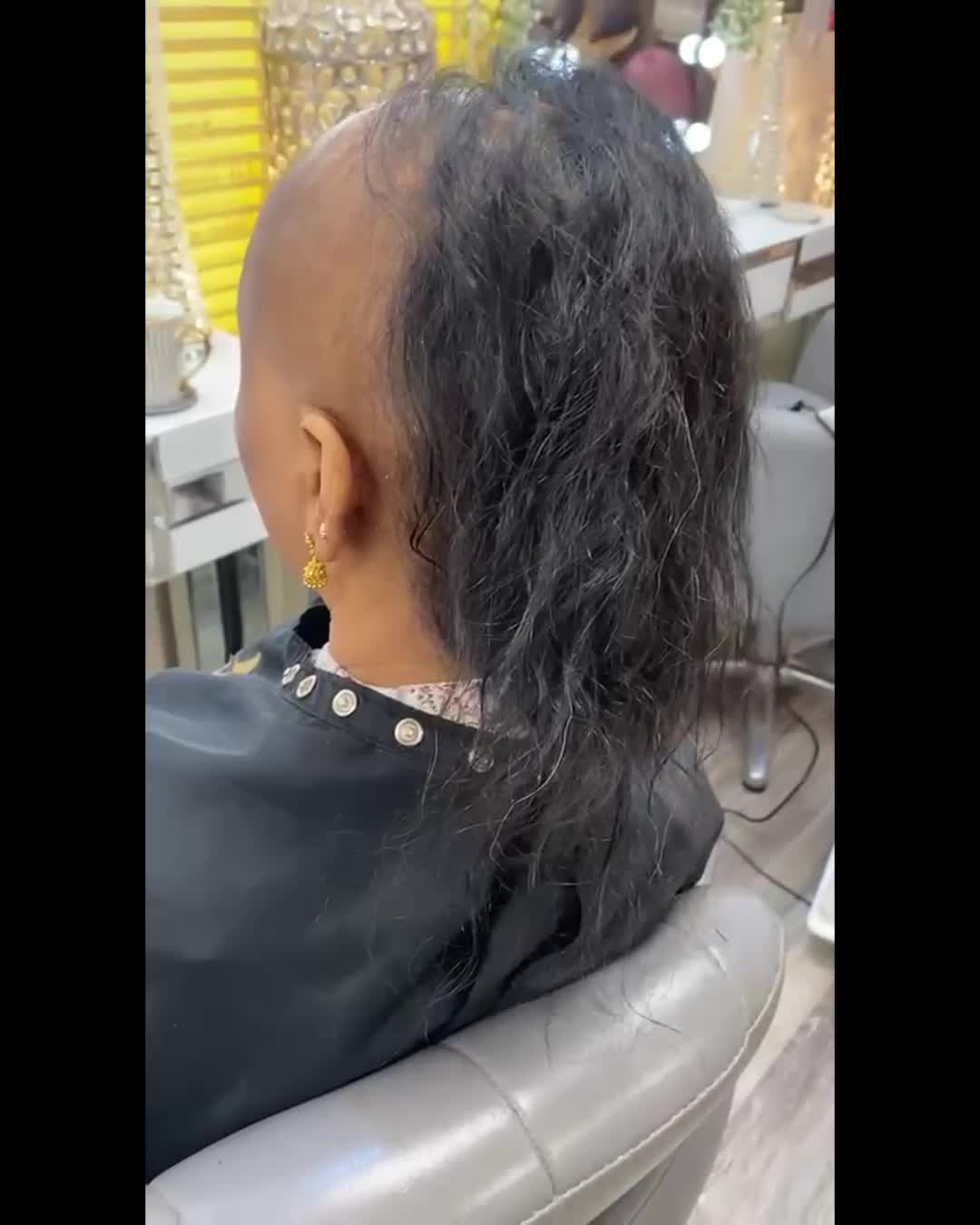 @Godiva Hair Loss Specialists