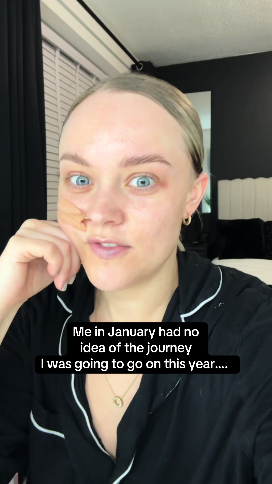 @Soph | IBD/POTS/STOMA& co🦓