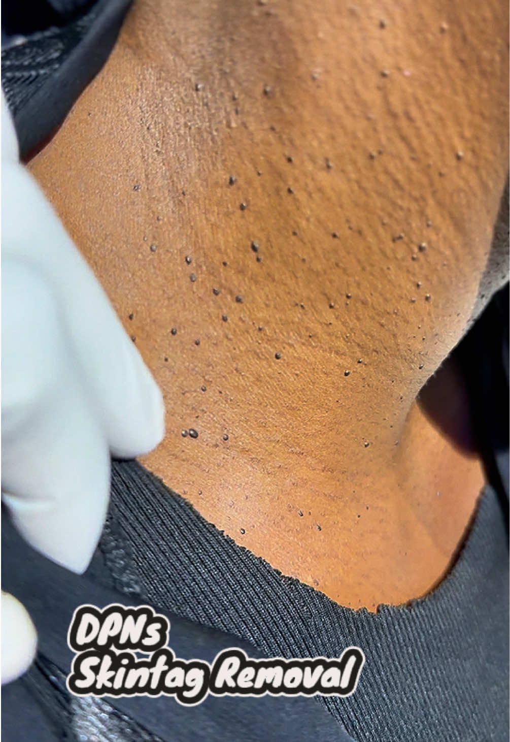 @Skin Dictionary