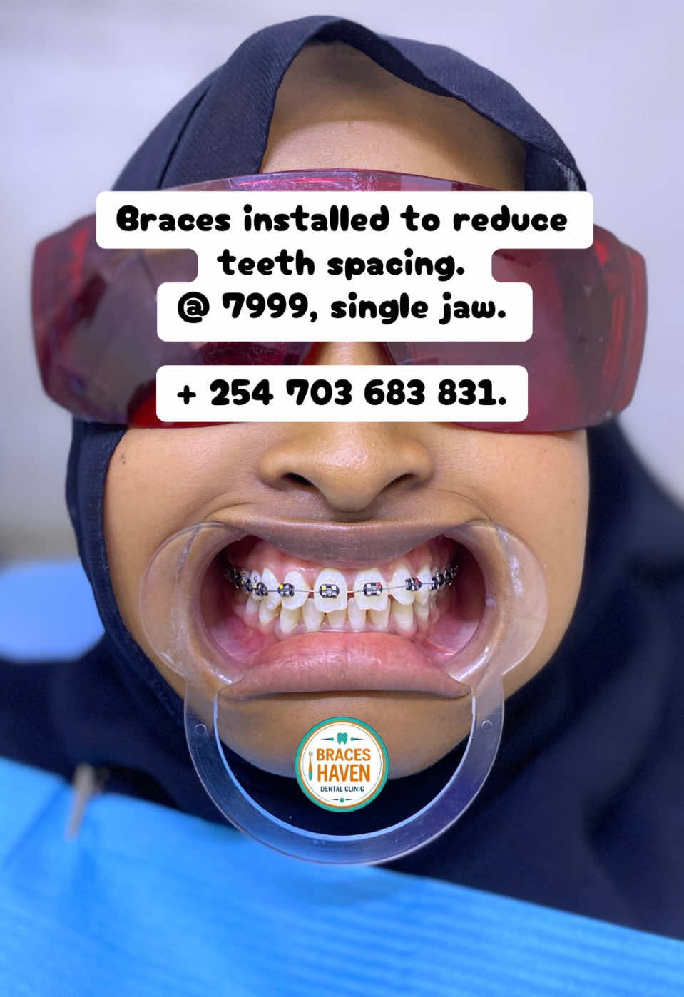 @Braces Haven Nairobi Dental