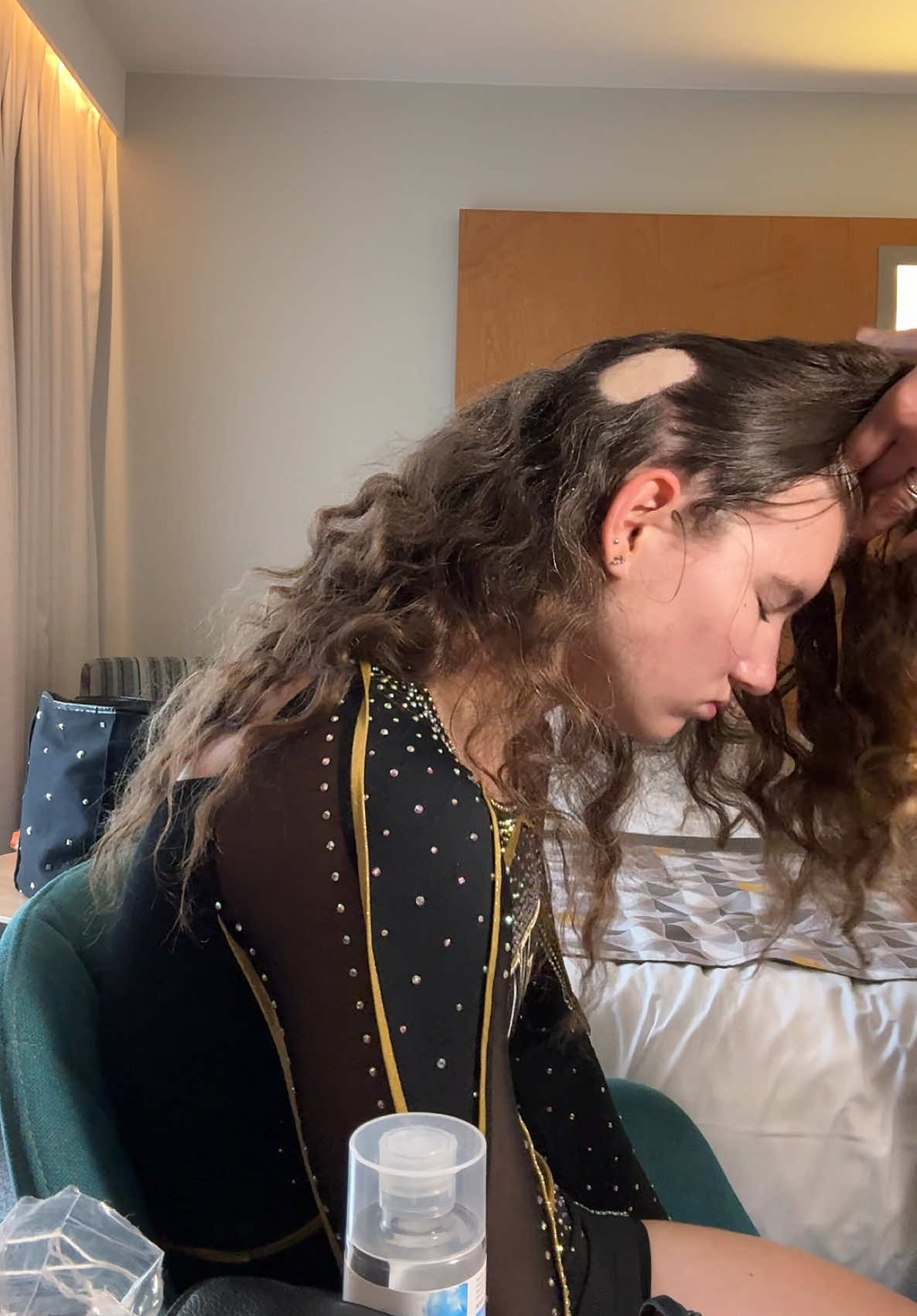 @coco❤️&zwj;🩹and💇&zwj;♀️burt.the.burn