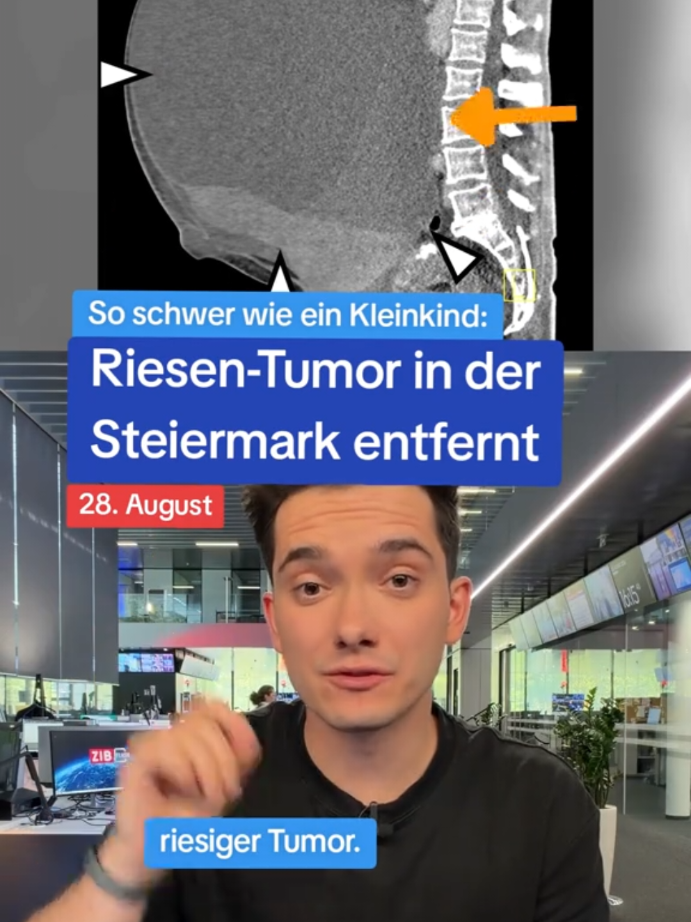 @Zeit im Bild - ZIB