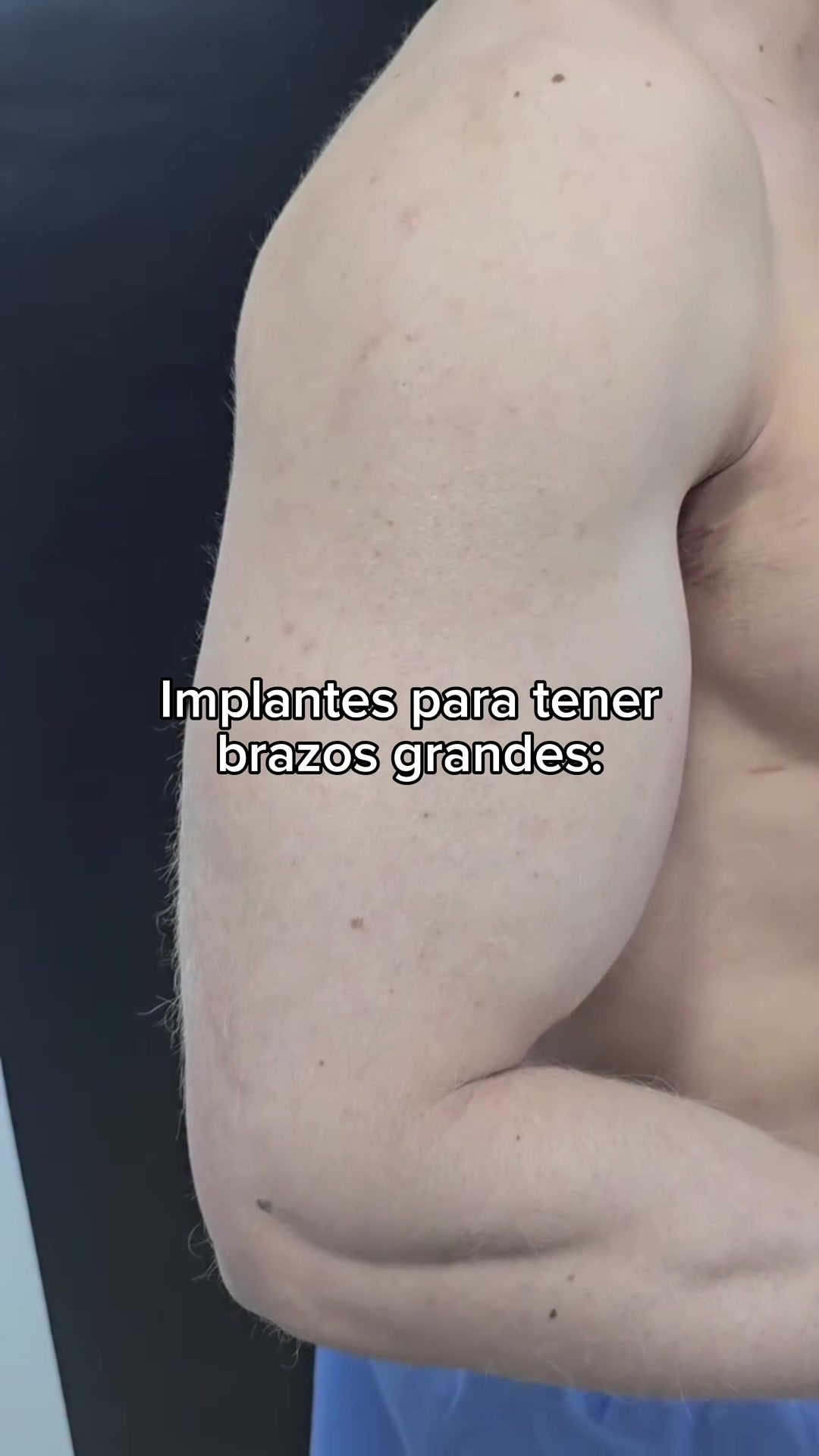 @Chuyst