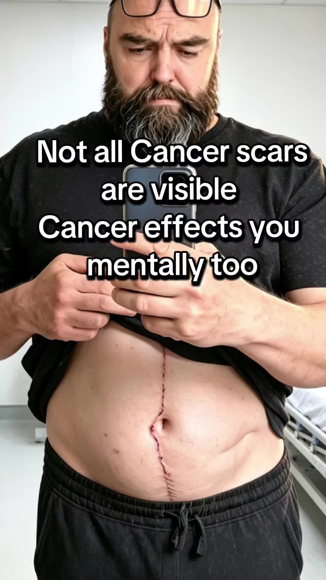 @BPD
