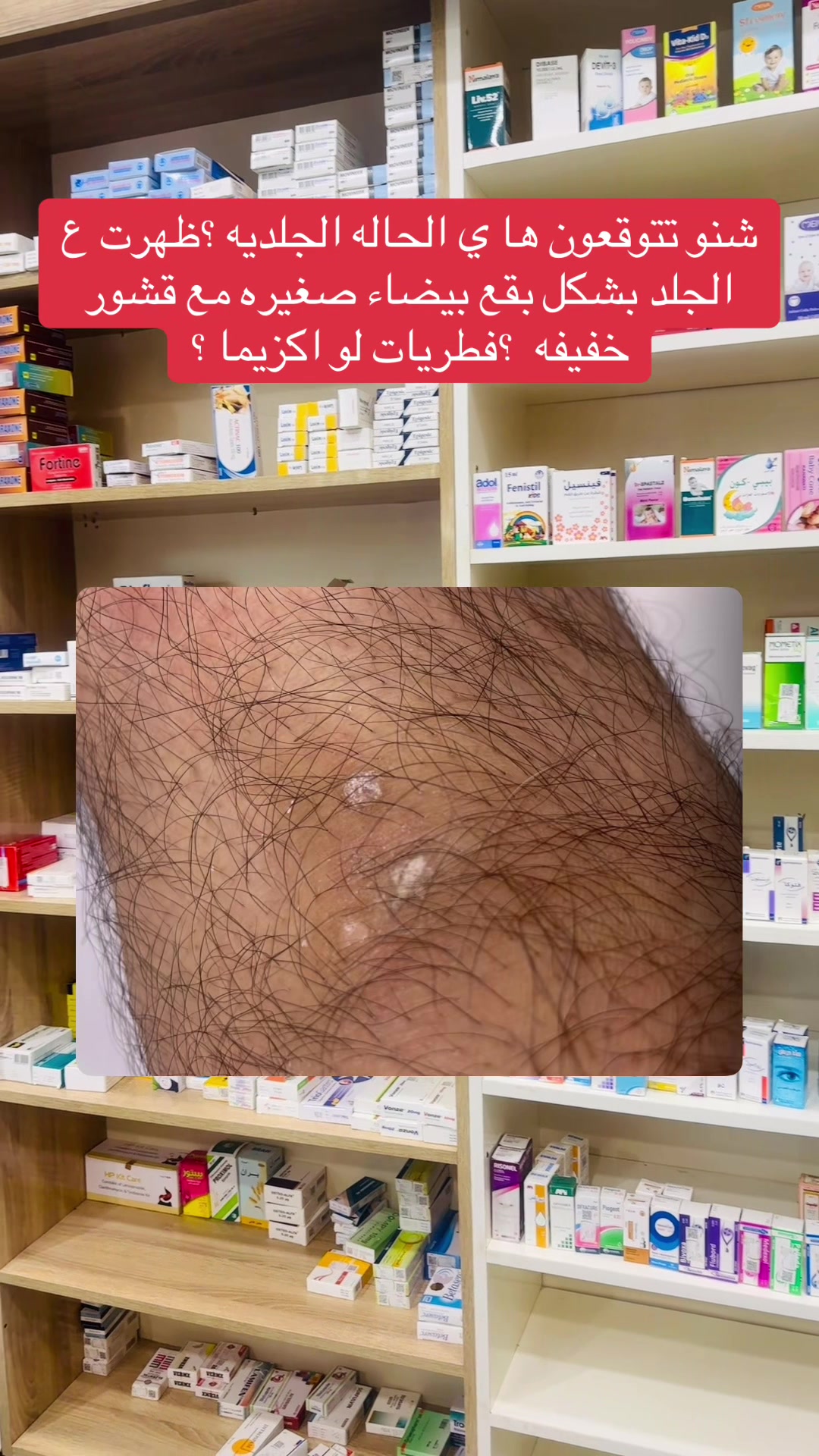 @Noor 🫶🏼