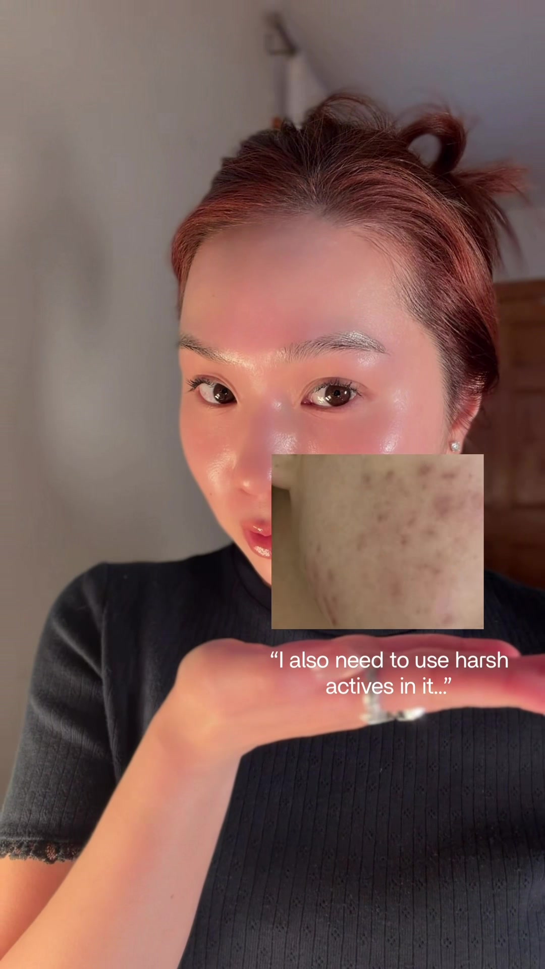 @Song Of Skin