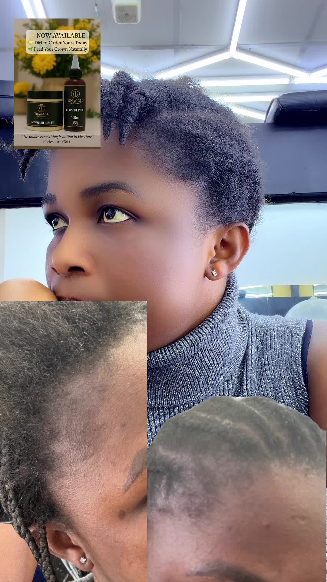 @TINAGOLD BOTANICAL®Hair Growth