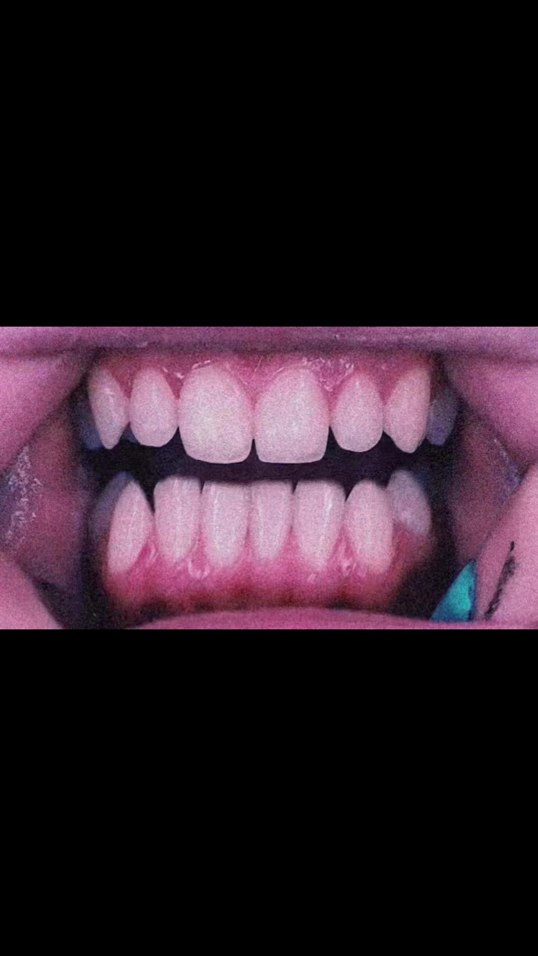 @•๐•