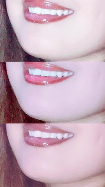@Dimple girl😜