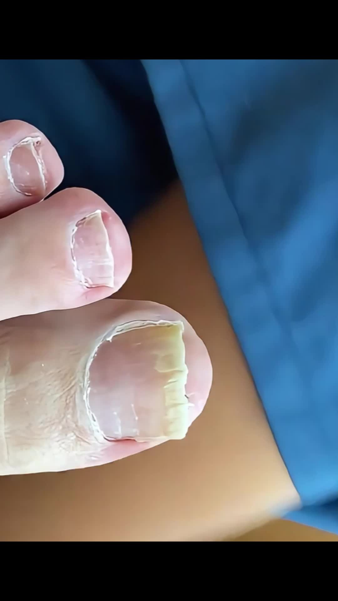 @Toenails.clips