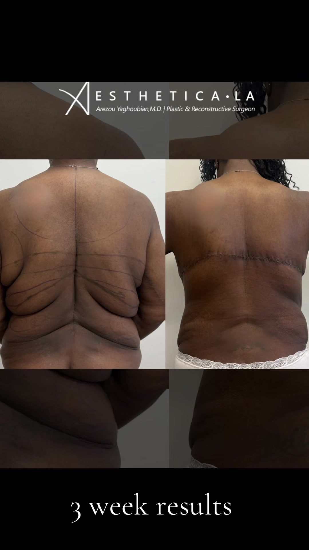 @AESTHETICA LA-Dr.Yaghoubian