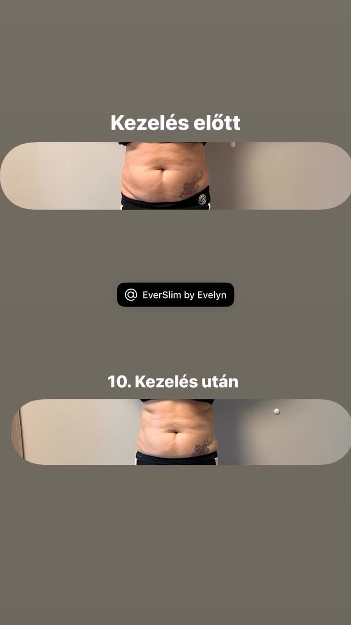 @EverSlim by Evelyn🌸