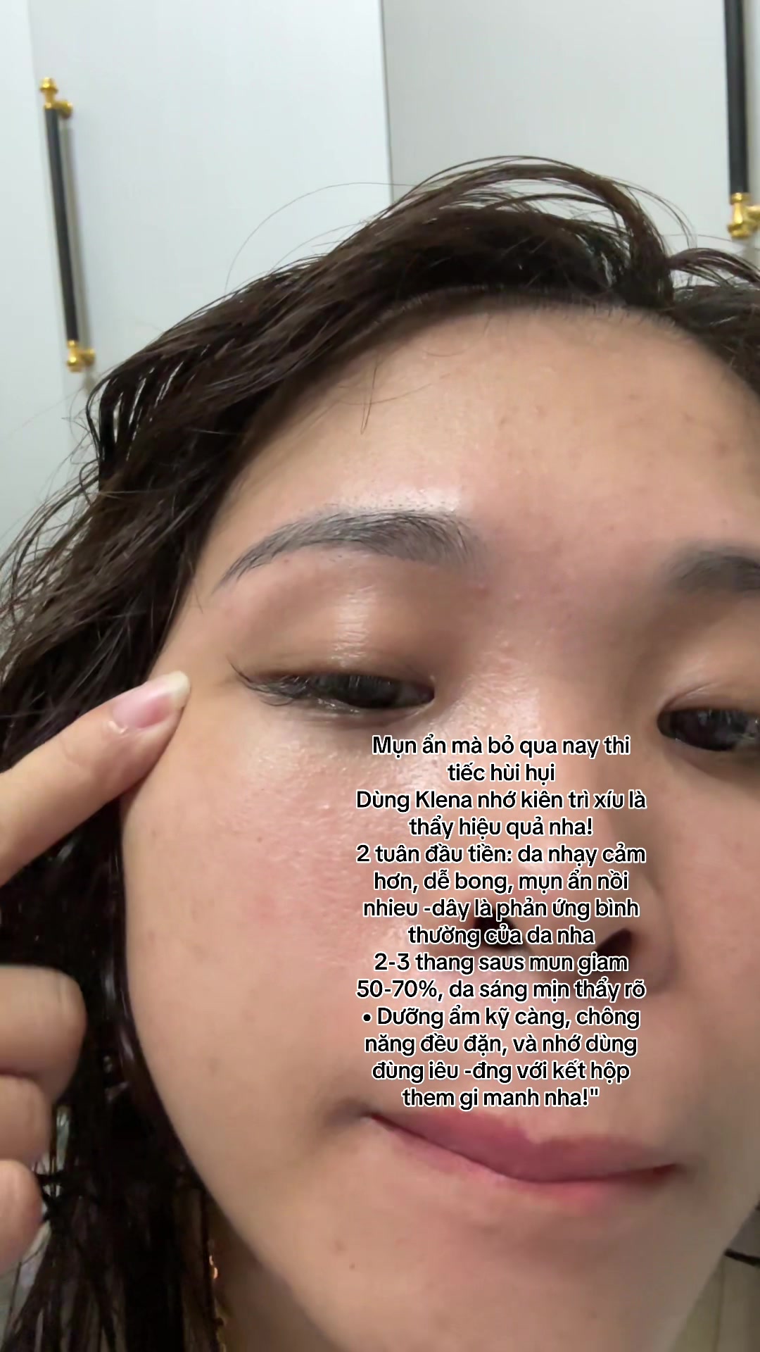 @Hoa Acne Skincare🌷