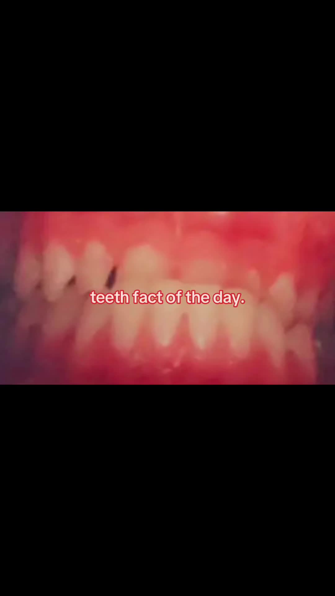 @I leik teeth moer thna mysefl.