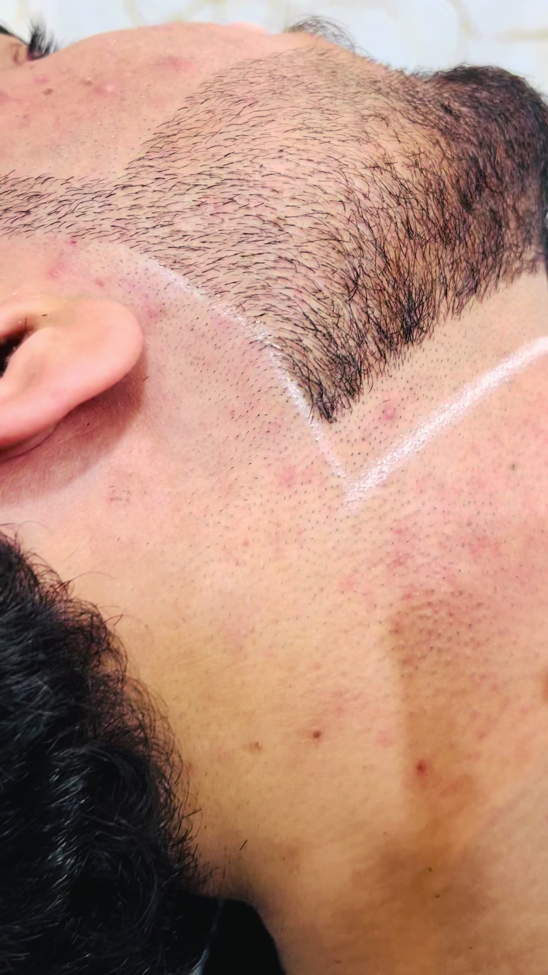 @Laser Grafix clinic