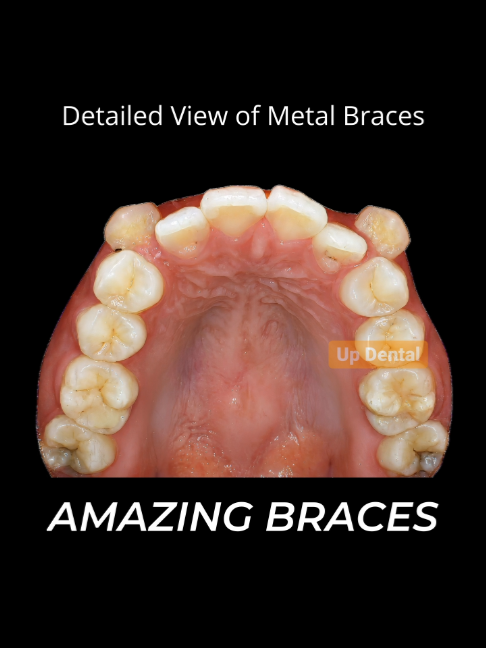 @Nha khoa niềng răng Up Dental