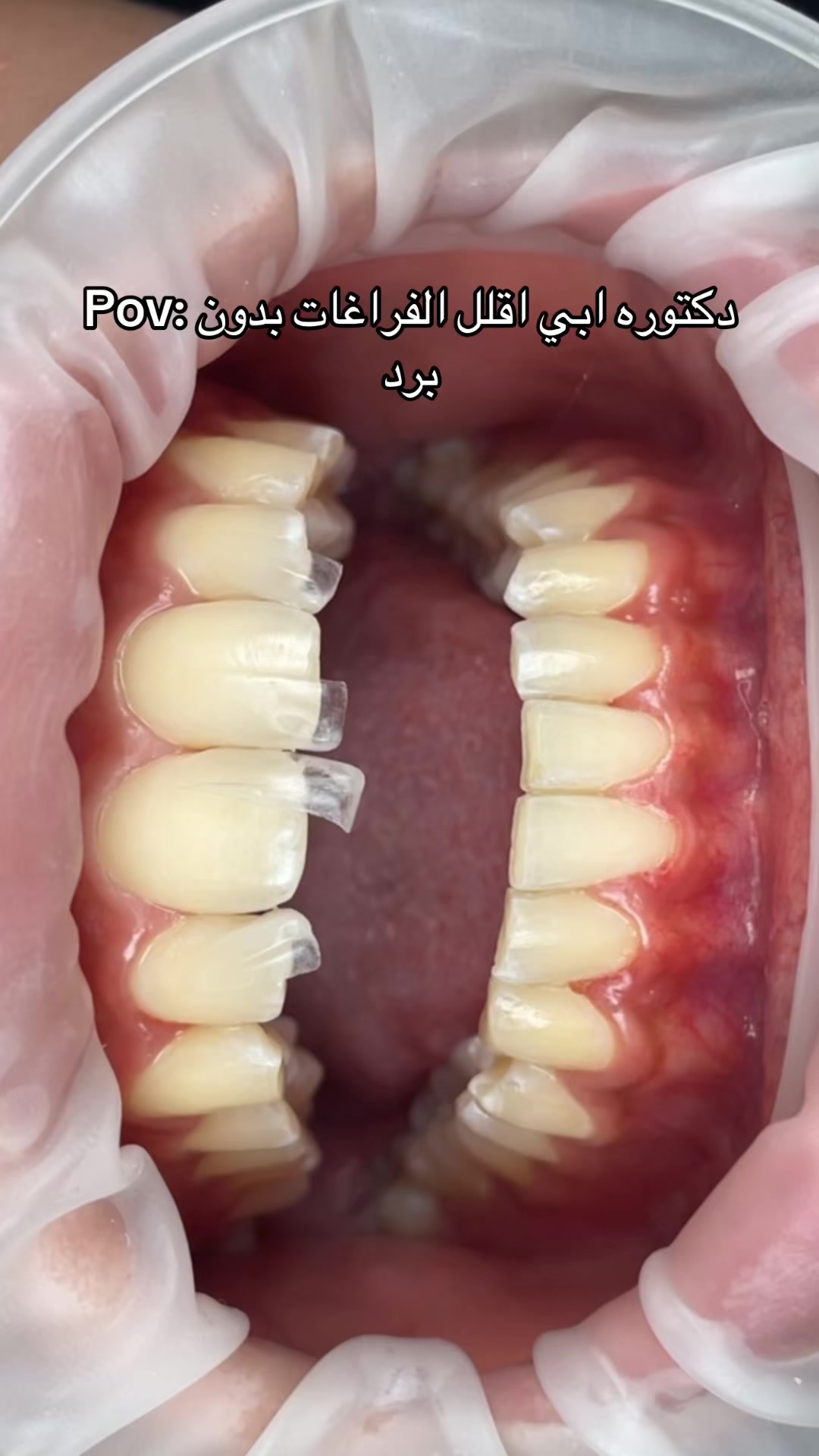 @Dr. Abrar Alhababi