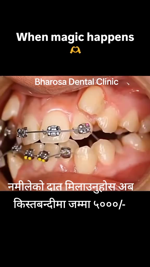 @Nisha Raut