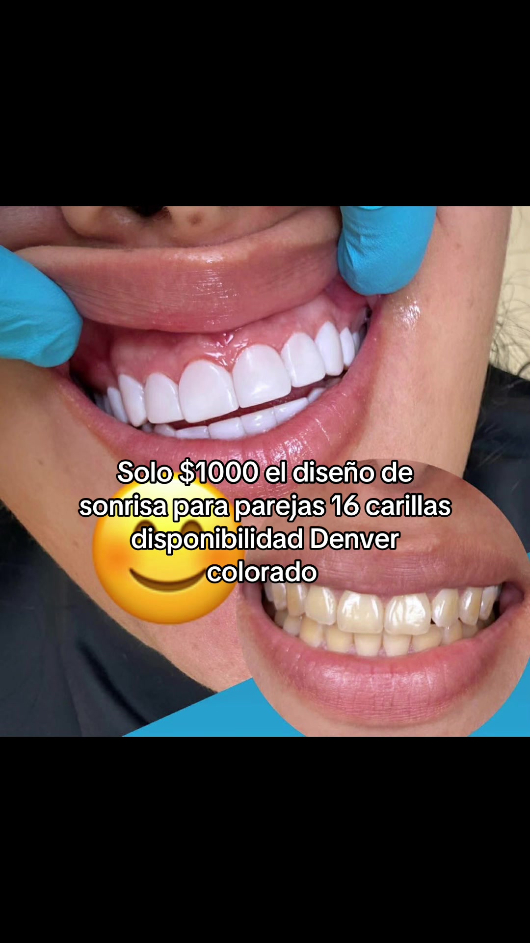 @Smilesdesigncaliope