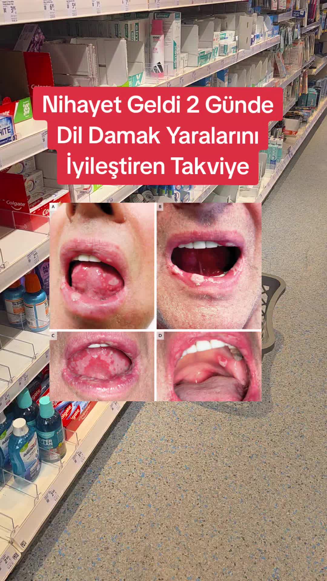 @Gurbet Ana