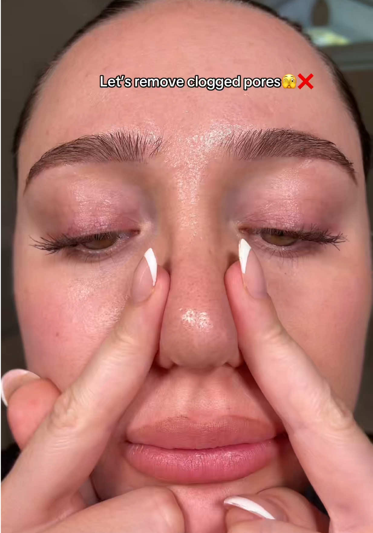@Serena Lakkiss