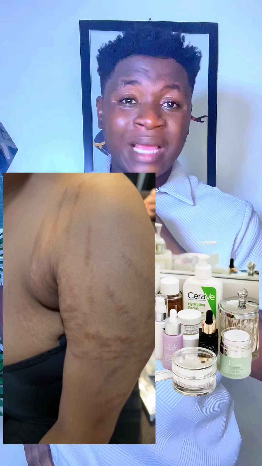 @Radiant skin